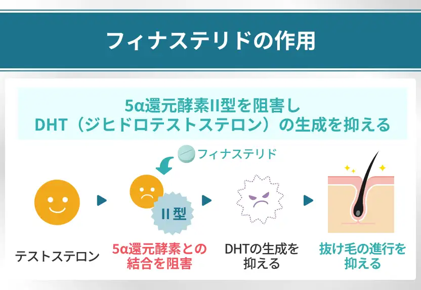 フィナステリドは飲み続けている間だけ抜け毛を抑える薬