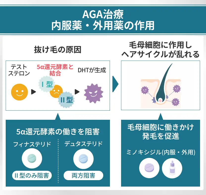 AGA治療の内服薬と外用薬の作用