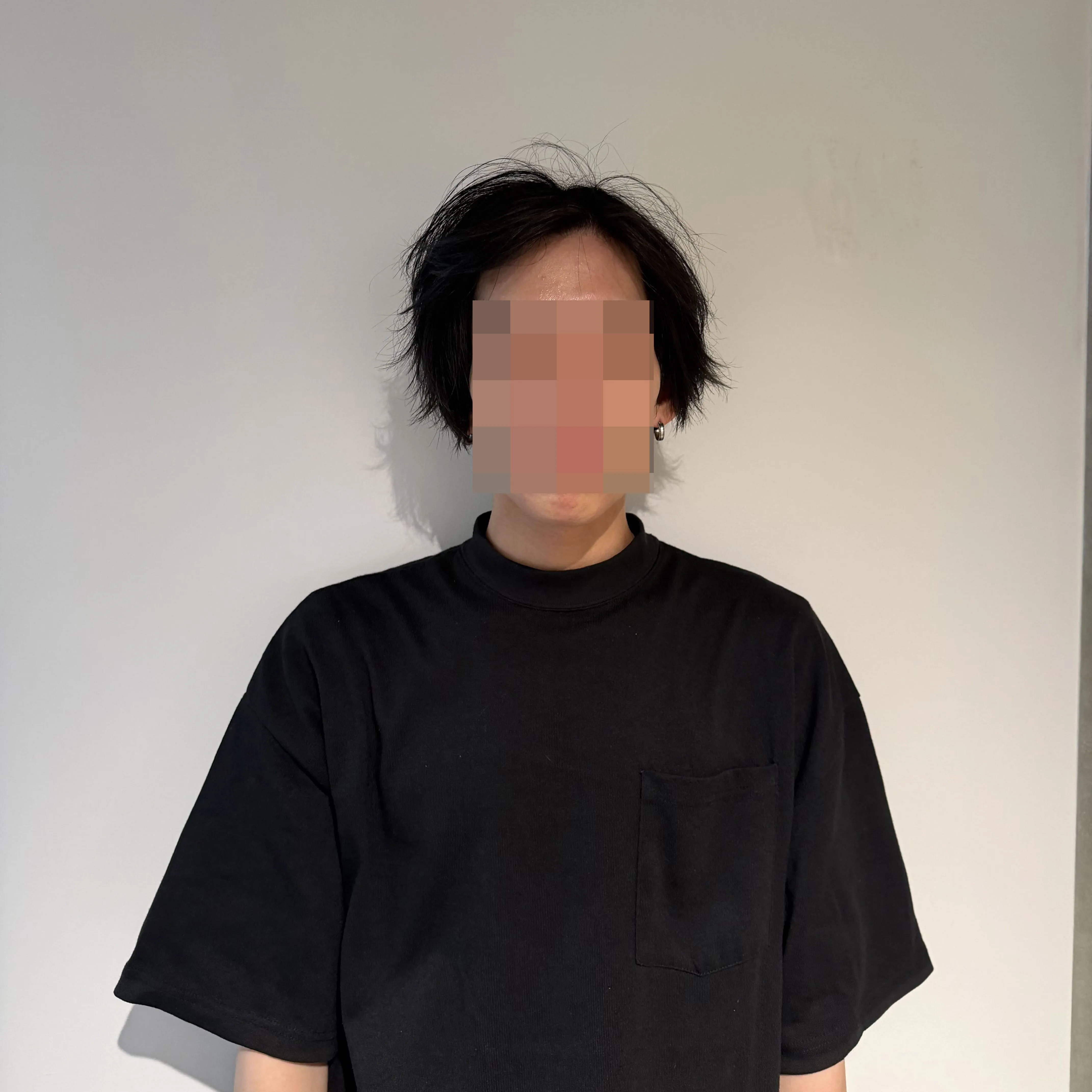 AGAオンライン診療を受診した29歳男性